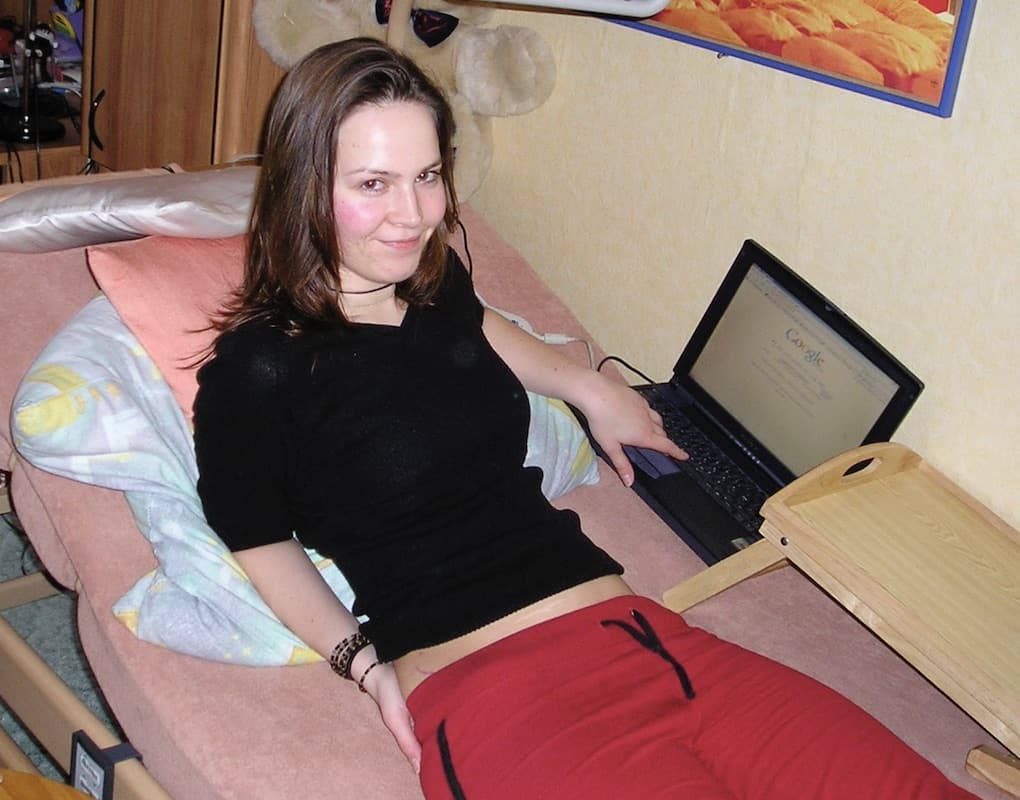 2006 nach der ersten Dreifachen Beckenosteotomie zu Hause