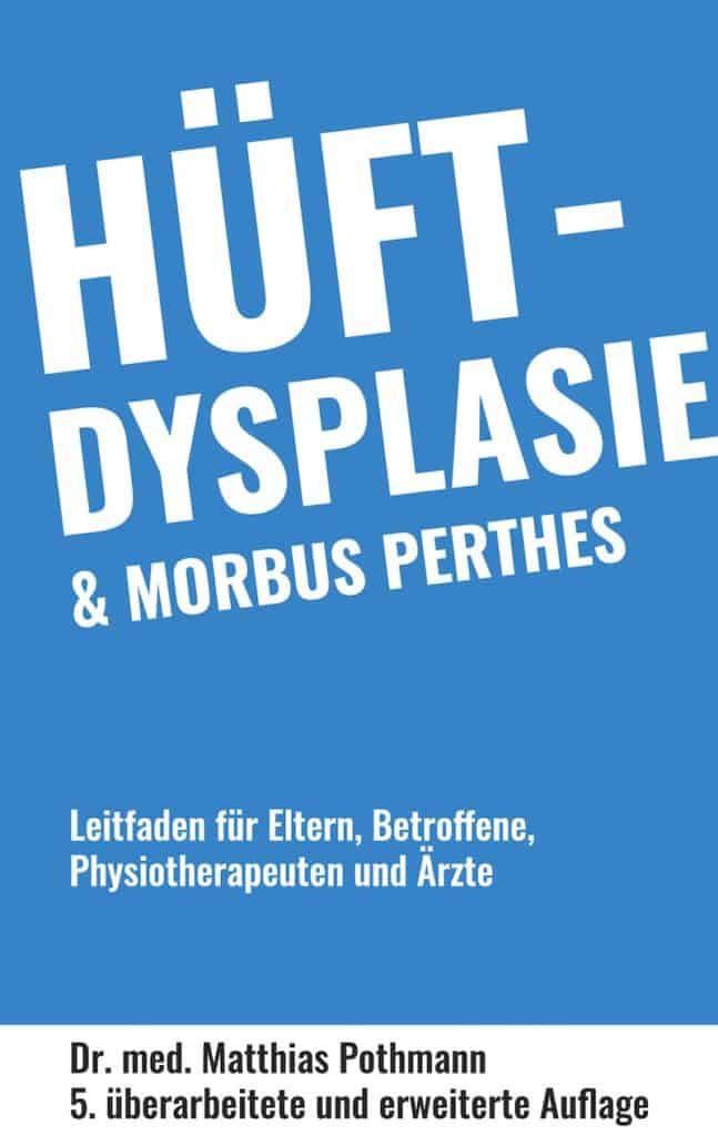 Hueftdysplasie Leitfaden von Dr. Matthias Pothmann
