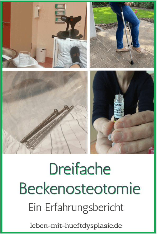 hueftdysplasie operation erfahrungen pinit