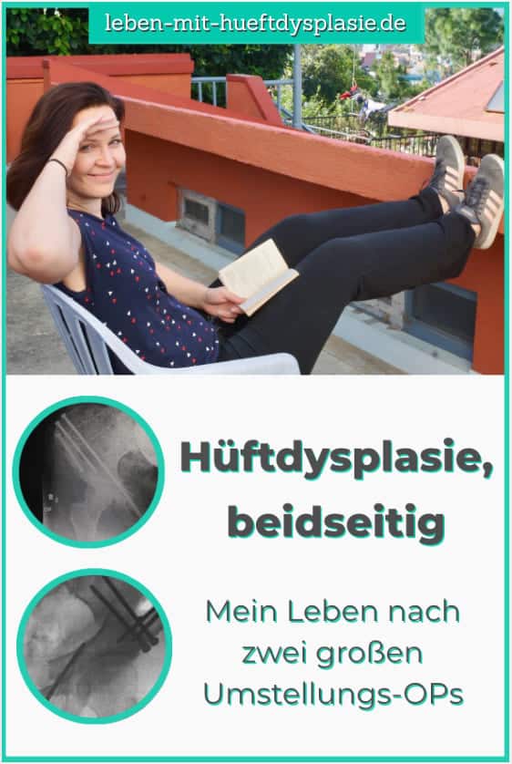 Hüftdysplasie bei Erwachsenen Pinterest Bild