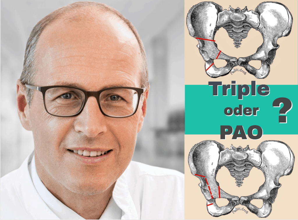 Pao-oder-Triple-Prof-Windhagen