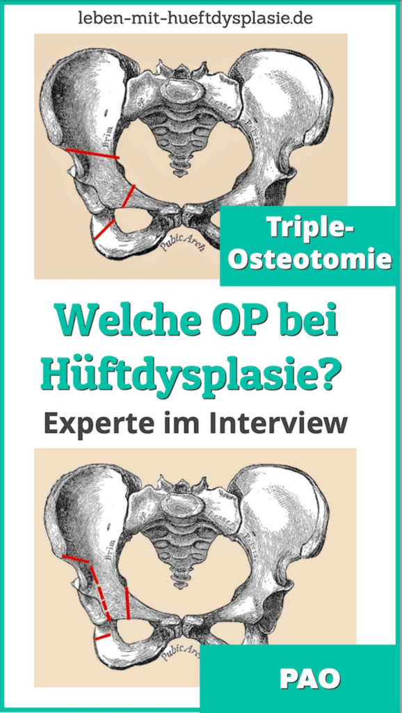 Triple oder PAO pinit