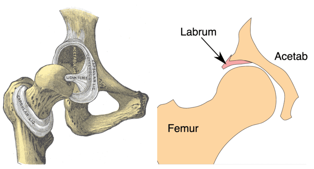 Hüftdysplasie Symptome: Das Labrum an der Hüftgelenkpfanne kann reißen